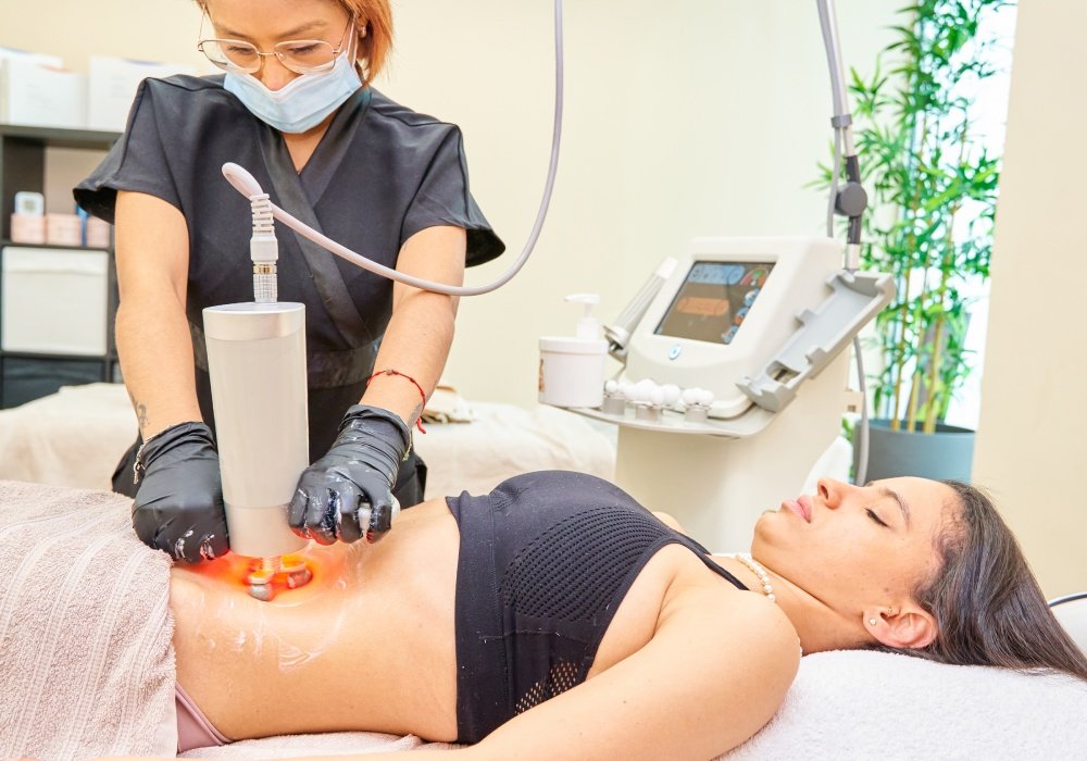 body contouring marketing